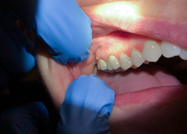Best Walk-In Emergency Dental Services in Geneva, WA