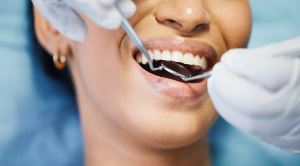 Best Emergency Pediatric Dental Care in Geneva, WA